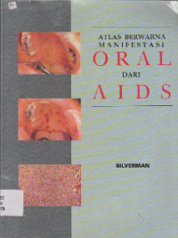 Image of ATLAS BERWARNA MANIFESTASI Oral dari Aids