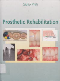 Image of PROSTHETIC REHABILITATION
