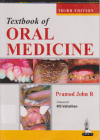 TEXT BOOK OF ORAL MEDICINE