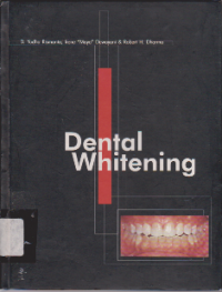 Image of Dental Whitening