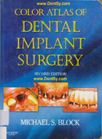Image of Color Atlas of Dental Implant Surgery