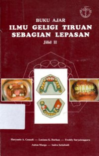 Image of Buku Ajar Ilmu Geligi Tiruan Sebagian Lepas. Jilid II
