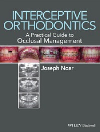 Interceptive Orthodontics A Practical Guide to Occlusal Management