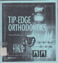 Tip - Edge Orthodontics