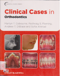 CLINICAL CASES IN ORTHODONTICS