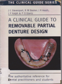 A CLINICAL GUIDE TO REMOVABLE PARTIAL DENTURES DESIGN